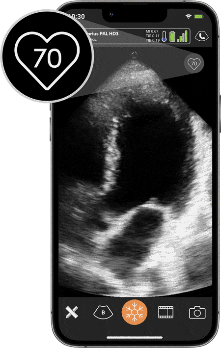 Phone-Portrait-Video-Heart-Rate-ezgif.com-optimize