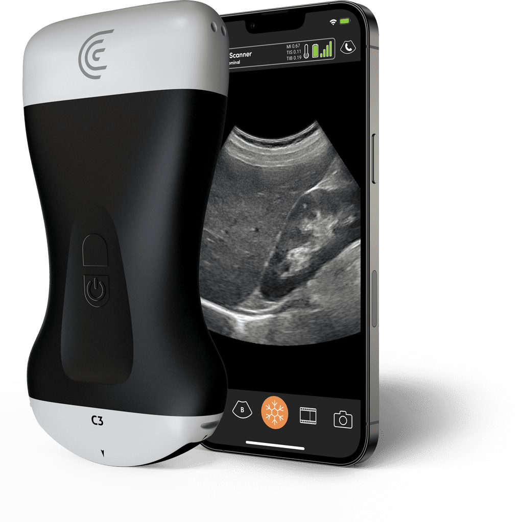 Product-C3-Convex-Handheld-Portable-Wireless-Ultrasound-Scanner