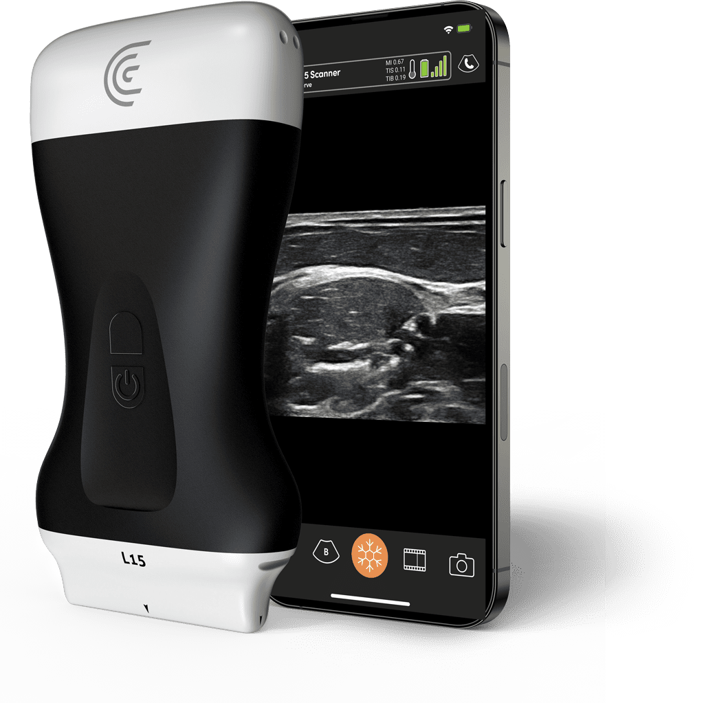 Product-L15-High-Freq-Linear-Handheld-Portable-Wireless-Ultrasound-Scanner