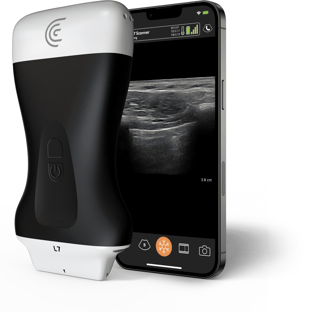 Product-L7-Linear-Handheld-Portable-Wireless-Ultrasound-Scanner