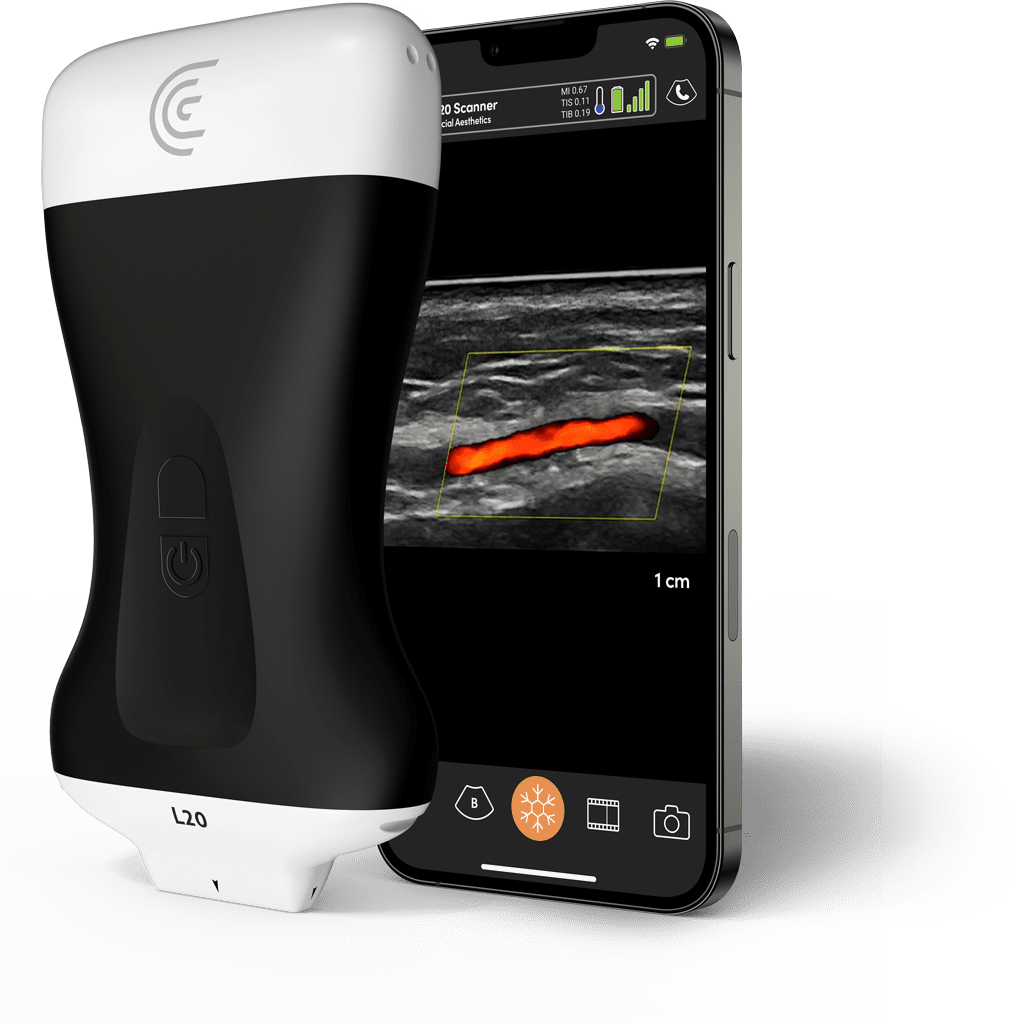 Product-L20-Ultra-High-Freq-Linear-Handheld-Portable-Wireless-Ultrasound-Scanner