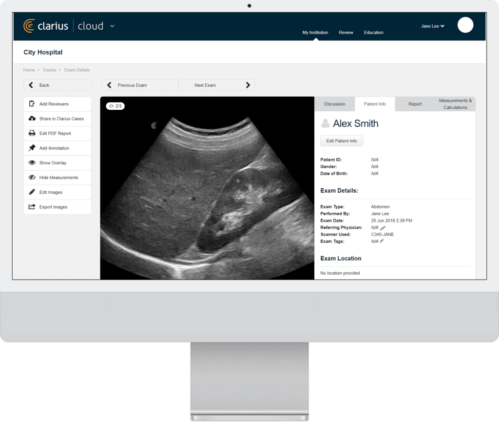 clarius-cloud-online-ultrasound-exam-managment-1024x865